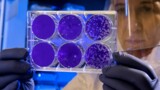 Хантавирус: В Китае зафиксирована первая смерть от неизвестного вируса
